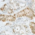Immunohistochemistry (Formalin/PFA-fixed paraffin-embedded sections) - Anti-MSH6 antibody [SP93] - BSA and Azide free (AB238805)