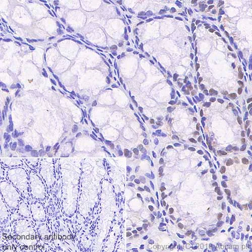 Immunohistochemistry (Formalin/PFA-fixed paraffin-embedded sections) - Anti-MSH6 antibody [SP93] - BSA and Azide free (AB238805)