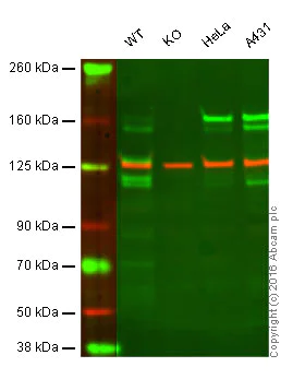 Western blot - Anti-MSH6 antibody [SP93] - BSA and Azide free (AB238805)