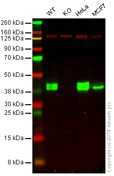 Western blot - Anti-MSI2 antibody [EP1305Y] (AB76148)