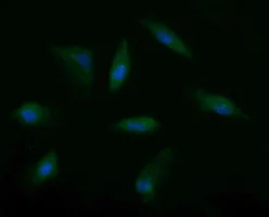 Immunocytochemistry/ Immunofluorescence - Anti-MSI2 antibody [OTI2F10] (AB156770)