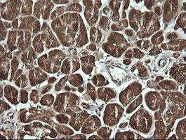 Immunohistochemistry (Formalin/PFA-fixed paraffin-embedded sections) - Anti-MSI2 antibody [OTI2F10] (AB156770)