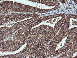 Immunohistochemistry (Formalin/PFA-fixed paraffin-embedded sections) - Anti-MSI2 antibody [OTI2F10] (AB156770)