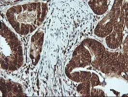 Immunohistochemistry (Formalin/PFA-fixed paraffin-embedded sections) - Anti-MSI2 antibody [OTI2F10] (AB156770)