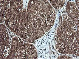 Immunohistochemistry (Formalin/PFA-fixed paraffin-embedded sections) - Anti-MSI2 antibody [OTI2F10] (AB156770)