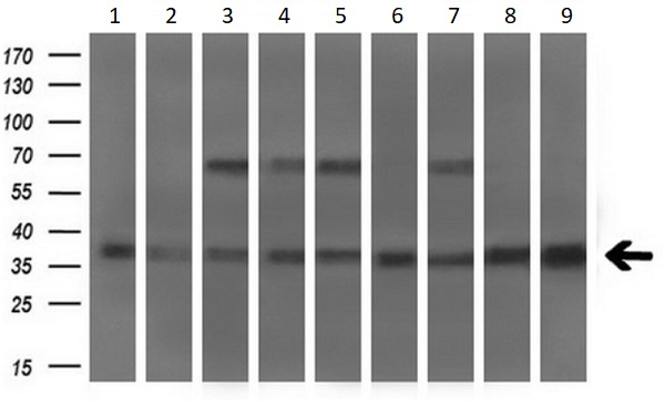 Western blot - Anti-MSI2 antibody [OTI2F10] (AB156770)