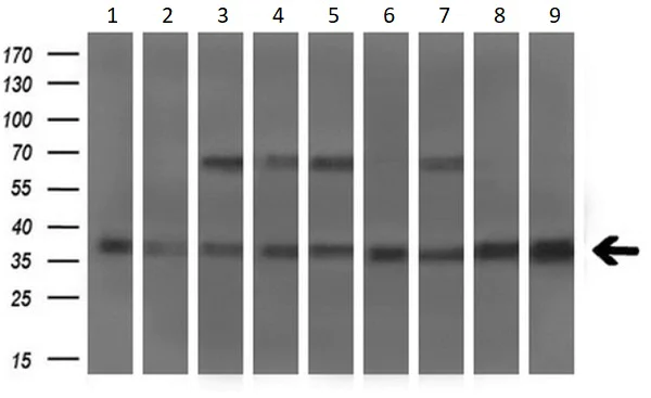 Western blot - Anti-MSI2 antibody [OTI2F10] (AB156770)