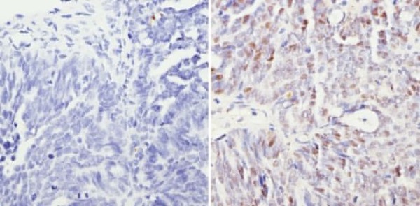 Immunohistochemistry (Formalin/PFA-fixed paraffin-embedded sections) - Anti-mSin3A antibody - ChIP Grade (AB3479)