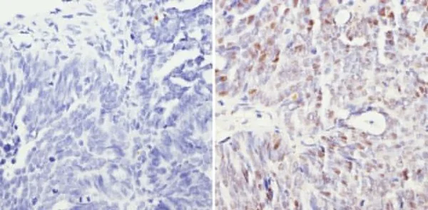 Immunohistochemistry (Formalin/PFA-fixed paraffin-embedded sections) - Anti-mSin3A antibody - ChIP Grade (AB3479)