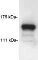 Western blot - Anti-mSin3A antibody - ChIP Grade (AB3479)