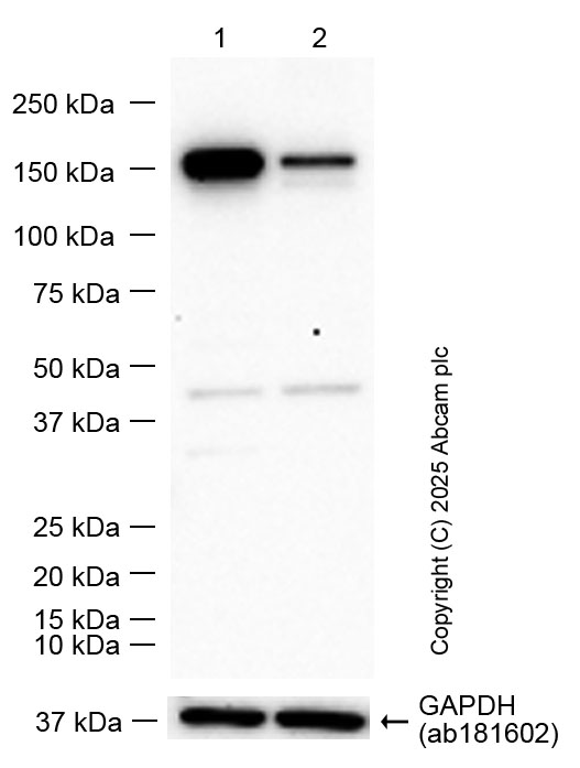 Western blot - Anti-mSin3a antibody [EPR27103-53] (AB307197), expandable thumbnail