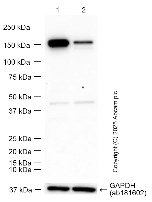 Western blot - Anti-mSin3a antibody [EPR27103-53] - BSA and Azide free (AB307198)