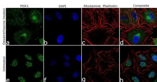 Immunocytochemistry/ Immunofluorescence - Anti-MSK1 antibody [RP23040226] (AB313555)
