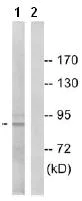 Western blot - Anti-MSK1 (phospho S212) antibody (AB79499)