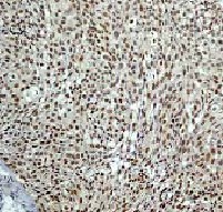 Immunohistochemistry (Formalin/PFA-fixed paraffin-embedded sections) - Anti-MSK1 (phospho S376) antibody [E375] - BSA and Azide free (AB210529), expandable thumbnail