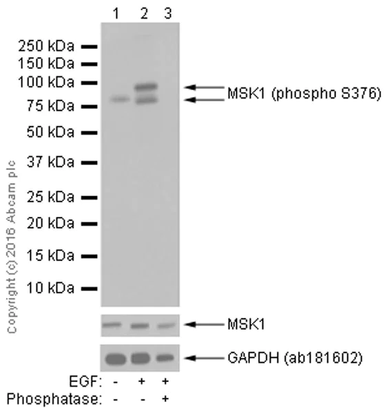 Western blot - Anti-MSK1 (phospho S376) antibody [E375] - BSA and Azide free (AB210529)