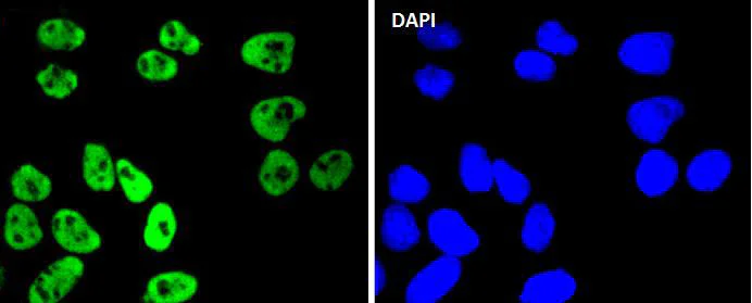 Immunocytochemistry/ Immunofluorescence - Anti-MSK1 (phospho S376) antibody [SN63-05] (AB326624)