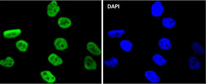 Immunocytochemistry/ Immunofluorescence - Anti-MSK1 (phospho S376) antibody [SN63-05] (AB326624)