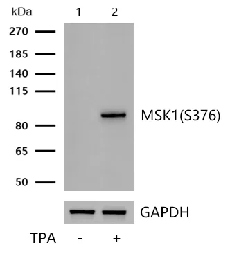 Western blot - Anti-MSK1 (phospho S376) antibody [SN63-05] (AB326624)
