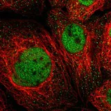 Immunocytochemistry/ Immunofluorescence - Anti-MSL1 antibody (AB121718)