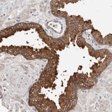 Immunohistochemistry (Formalin/PFA-fixed paraffin-embedded sections) - Anti-MSL1 antibody (AB121718)