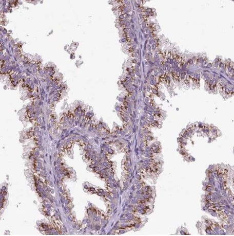 Immunohistochemistry (Formalin/PFA-fixed paraffin-embedded sections) - Anti-MSMP antibody (AB185471)