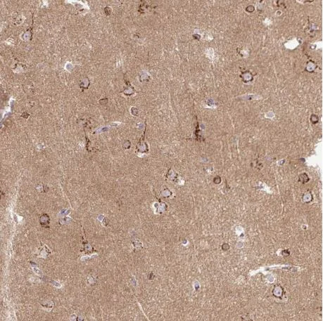 Immunohistochemistry (Formalin/PFA-fixed paraffin-embedded sections) - Anti-MSMP antibody (AB185471)