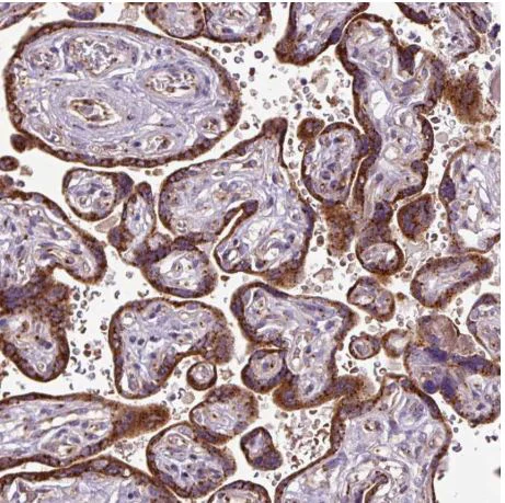 Immunohistochemistry (Formalin/PFA-fixed paraffin-embedded sections) - Anti-MSMP antibody (AB185471)