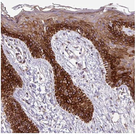 Immunohistochemistry (Formalin/PFA-fixed paraffin-embedded sections) - Anti-MSMP antibody (AB185471)