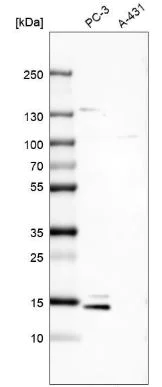 Western blot - Anti-MSMP antibody (AB185471)