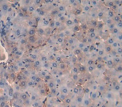 Immunohistochemistry (Formalin/PFA-fixed paraffin-embedded sections) - Anti-MSP/MST1 antibody (AB231138), expandable thumbnail