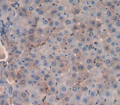 Immunohistochemistry (Formalin/PFA-fixed paraffin-embedded sections) - Anti-MSP/MST1 antibody (AB231138)