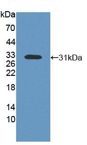 Western blot - Anti-MSP/MST1 antibody (AB231138), expandable thumbnail