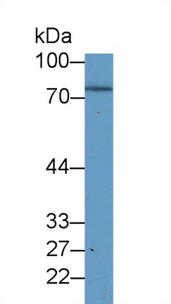 Western blot - Anti-MSP/MST1 antibody (AB231138), expandable thumbnail