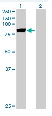 Western blot - Anti-MSP/MST1 antibody (AB76822), expandable thumbnail