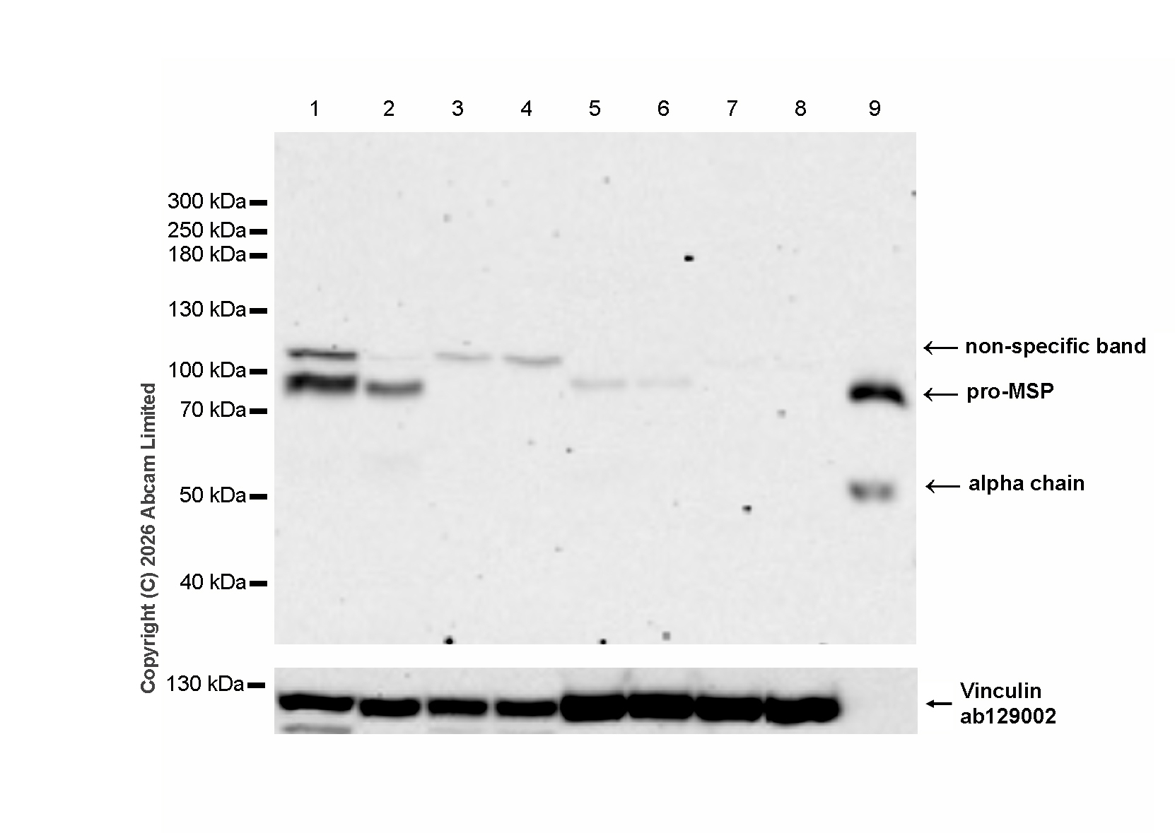 Western blot - Anti-MSP/MST1 antibody [EPR22184-180] (AB245190)