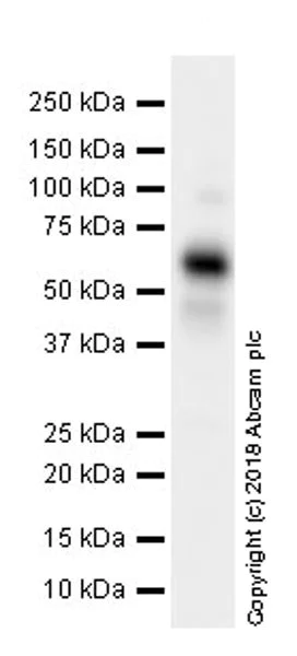 Western blot - Anti-MSP/MST1 antibody [EPR22184-180] (AB245190)