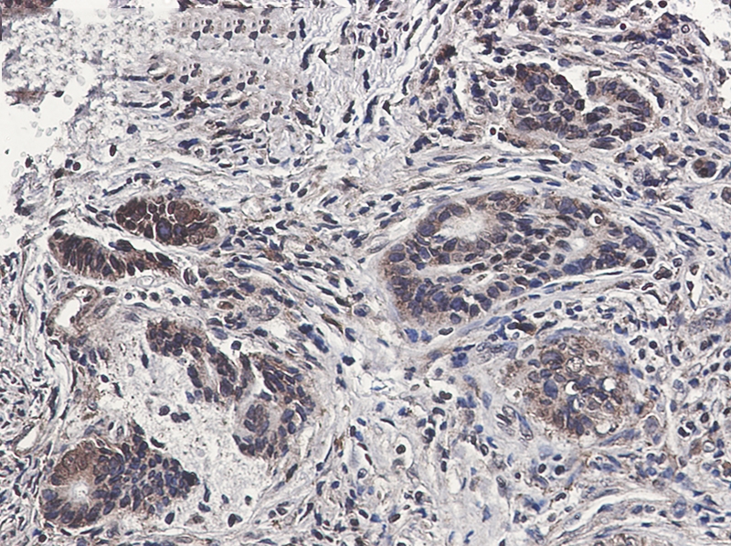 Immunohistochemistry (Formalin/PFA-fixed paraffin-embedded sections) - Anti-MSP/MST1 Antibody [S04-1D6] (AB317410), expandable thumbnail