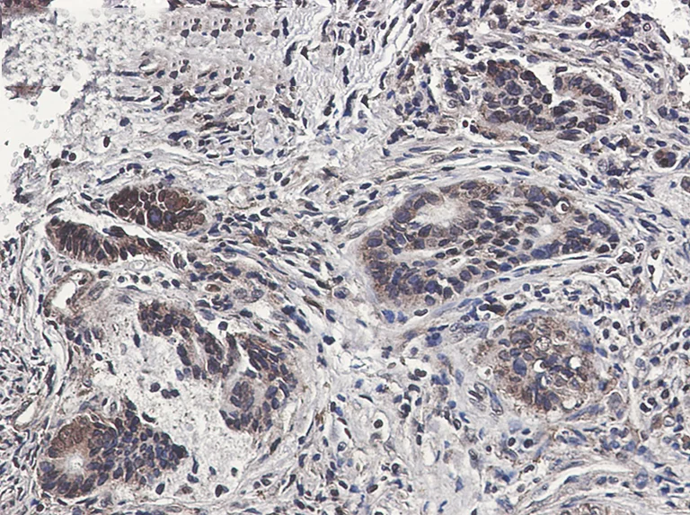 Immunohistochemistry (Formalin/PFA-fixed paraffin-embedded sections) - Anti-MSP/MST1 Antibody [S04-1D6] (AB317410)