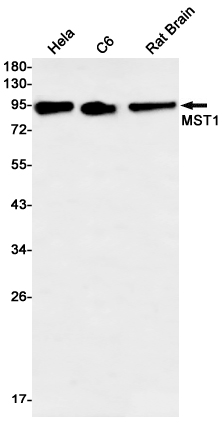 Western blot - Anti-MSP/MST1 Antibody [S04-1D6] (AB317410), expandable thumbnail