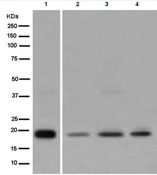 Western blot - Anti-MSRB3 antibody [EPR13664] (AB180584)