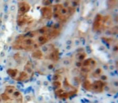 Immunohistochemistry (Formalin/PFA-fixed paraffin-embedded sections) - Anti-MSS1 antibody (AB233127)