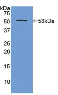 Western blot - Anti-MSS1 antibody (AB233127)