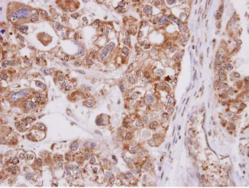 Immunohistochemistry (Formalin/PFA-fixed paraffin-embedded sections) - Anti-MST antibody (AB154514)