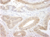 Immunohistochemistry (Formalin/PFA-fixed paraffin-embedded sections) - Anti-MST1/MST2 antibody (AB87322)