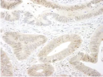 Immunohistochemistry (Formalin/PFA-fixed paraffin-embedded sections) - Anti-MST1/MST2 antibody (AB87322)