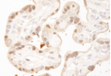Immunohistochemistry (Formalin/PFA-fixed paraffin-embedded sections) - Anti-MST1/MST2 antibody (AB87322)