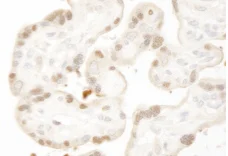 Immunohistochemistry (Formalin/PFA-fixed paraffin-embedded sections) - Anti-MST1/MST2 antibody (AB87322)