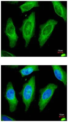 Immunocytochemistry/ Immunofluorescence - Anti-MST3 antibody (AB96705)