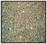 Immunohistochemistry (Formalin/PFA-fixed paraffin-embedded sections) - Anti-MST3 antibody [EP1468Y] (AB51137), expandable thumbnail